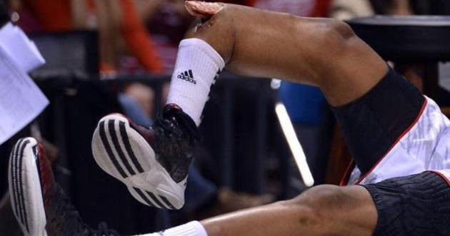 Kevin Ware Louisville NBA Player: Kevin Ware Broke His Leg During Their Game Against Duke