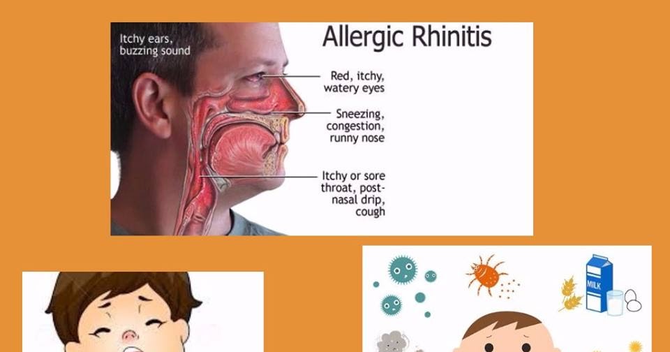 SriVisista Ayurveda Blogs ALLERGIC RHINITIS