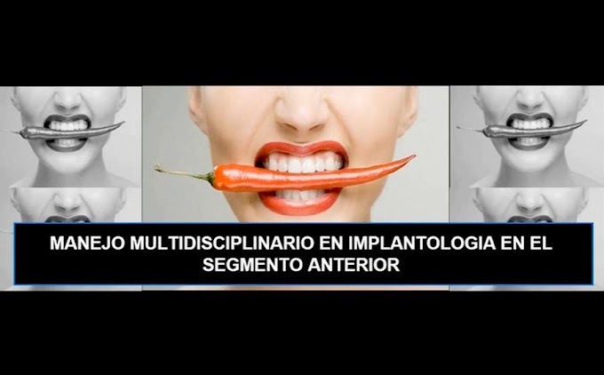 IMPLANTOLOGÍA: Tratamiento multidisciplinario en el segmento anterior - Videoconferencia del Dr. Edgar Grageda Núñez