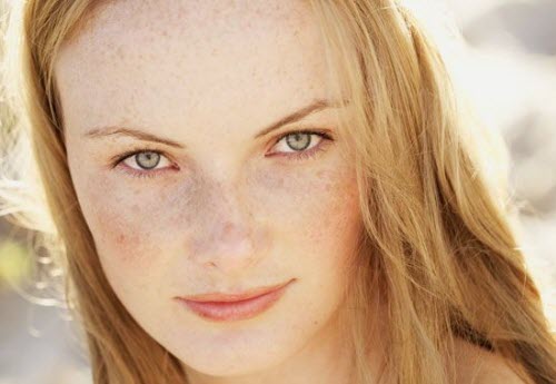 Cara Jitu Atasi Melasma Pada Wajah Cara Jitu Atasi Melasma Pada Wajah