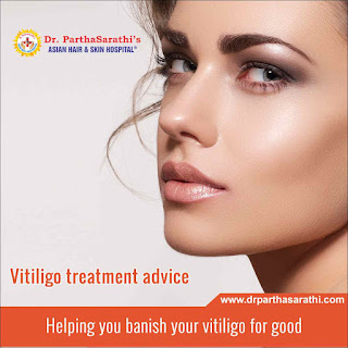 http://drparthasarathi.com/vitiligo-surgery/