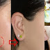 Get Hairless Skin in A Minute: This Magic Recipe Will Make Your Facial Hair Disappear Forever!
