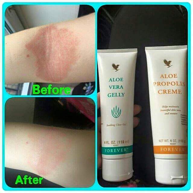 . KEBAIKAN ALOE PROPOLIS CREME FOREVER LIVING