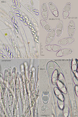 Sepultariella patavina