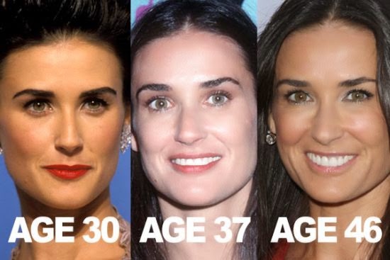 Demi Moore Plastic Surgery Breast Implants, Nose Job, Facelift and