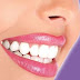 Prevención de absceso dental y cómo curar naturalmente el absceso en los dientes