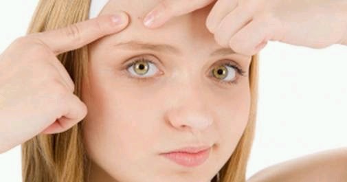 Roacutan 40mg precio