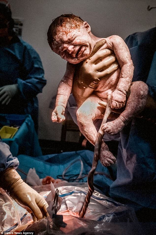 Stunning Pictures Portray The Reality Of Childbirth - CHANTELLE WATT