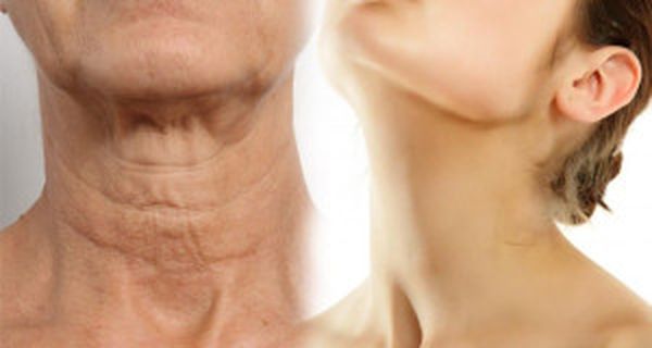 FORMAS SIMPLES PARA HACER SU CUELLO LUZCA MÁS JOVEN - ESTO ES SIMPLEMENTE INCREÍBLE FORMAS SIMPLES PARA HACER SU CUELLO LUZCA MÁS JOVEN - ESTO ES SIMPLEMENTE INCREÍBLE