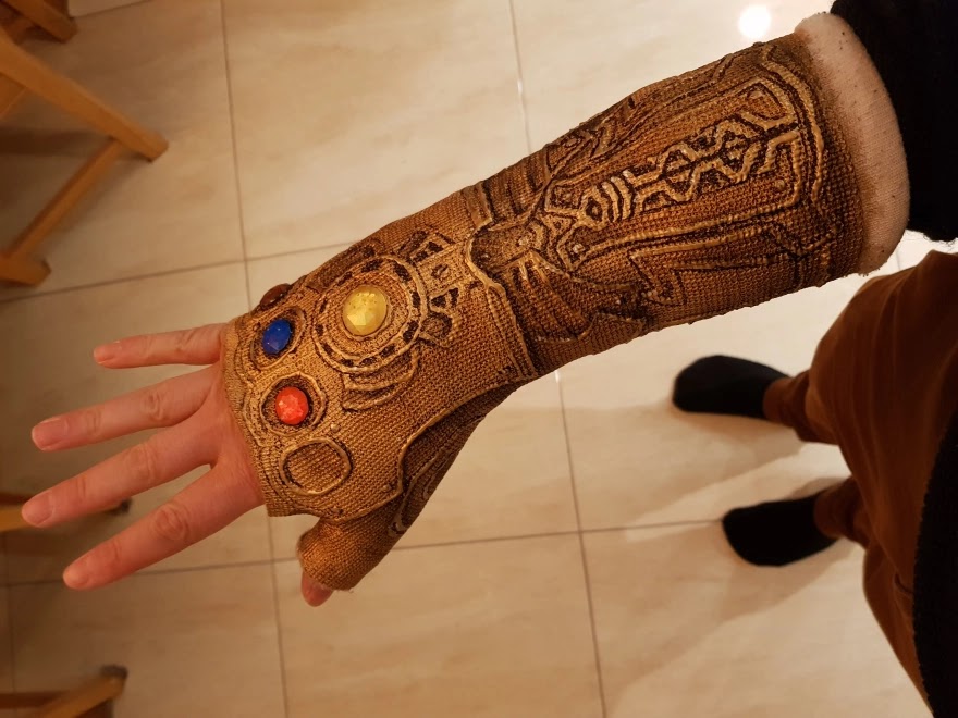 After This Guy Broke His Wrist, He Decided To Transform