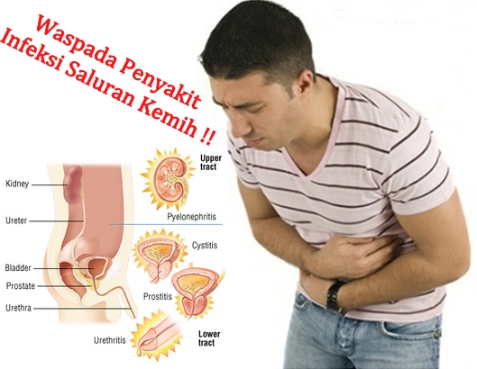Pilihan menyebar buletin perdagangan