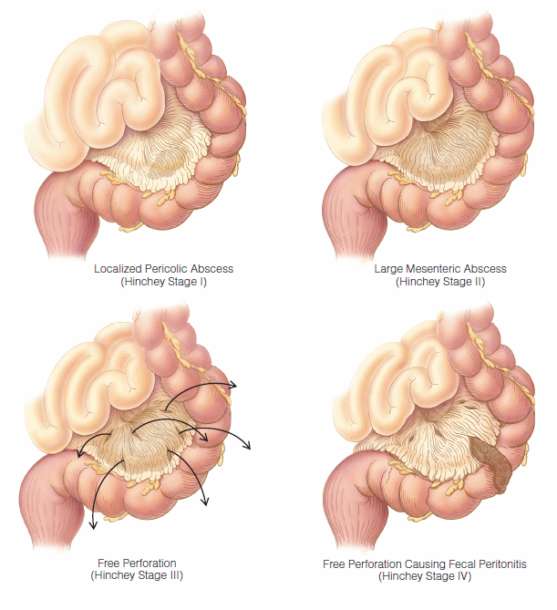 Goodrx sertraline