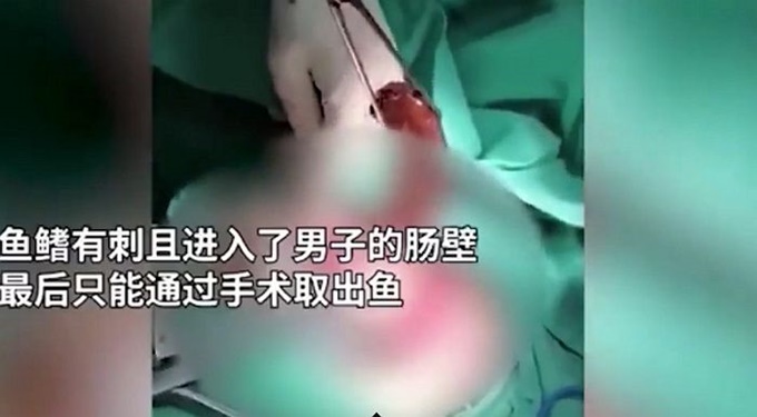 이미지에 대체텍스트 속성이 없습니다; 파일명은 19a5794hlyh7447ox3xe.jpg 입니다.