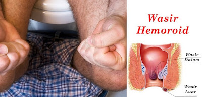 penderita wasir obat ambeien alami tanpa operasi obat ambeien alami ampuh obat ambeien alami paling ampuh obat ambeien alami untuk ibu hamil obat ambeien alami untuk ibu menyusui obat alami ambeien obat ambeien ampuh alami obat alami ambeien untuk ibu hamil obat ambeien yg ampuh alami obat ambeien alami yang ampuh obat ambeien alami mujarab obat ambeien alami tradisional obat ambeien alami dengan lidah buaya apa obat ambeien alami obat alami ambeien akut obat alami ambeien anak obat ambeien ampuh dan alami obat alami ambeien adalah obat ambeien alami yg ampuh obat ambeien alami bawang putih obat ambeien alami buat ibu hamil obat ambeien alami buah obat ambeien alami bagi ibu hamil obat alami ambeien berdarah obat ambeien bahan alami obat alami ambeien bengkak obat ambeien alami untuk bumil obat ambeien alami dengan bawang putih obat ambeien alami lidah buaya obat ambeien cara alami obat ambeien alami dan cepat cara mengatasi ambeien obat alami obat ambeien alami cepat obat ambeien alami kabupaten cilacap jawa tengah cari obat ambeien alami cara mengobati ambeien obat alami cara membuat obat ambeien alami obat ambeien alami dari tumbuhan obat ambeien alami dan cara membuat obat ambeien alami dan ampuh obat alami ambeien dalam obat alami wasir dan ambeien obat ambeien alami dan tradisional obat alami ambeien eksternal obat alami gejala ambeien obat alami untuk gejala ambeien obat alami mengatasi gejala ambeien obat ambeien alami herbal ambeien obat herbal alami obat ambeien alami saat hamil obat alami hilangkan ambeien obat alami ambeien pada ibu hamil obat herbal alami penyakit ambeien obat alami herbal buat ambeien obat alami ambeien ibu hamil obat alami ambeien internal obat alami ambeien ibu menyusui info obat alami ambeien obat alami ambeien keluar obat ambeien keluar darah alami obat alami menyembuh kan ambeyen obat ambeien alami kabupaten cilacap jawa tengah 53257 indonesia obat alami ambeien kronis obat alami ambeien keluar darah obat alami kucing ambeien obat alami ambeien saat kambuh obat alami untuk kucing ambeien obat alami ambeien luar obat alami untuk mengobati ambeien luar obat alami penyakit ambeien luar obat ambeien alami manjur obat mujarab ambeien alami obat ambeyen alami manjur obat ambeien alami setelah melahirkan obat alami mengatasi ambeien obat alami mengempeskan ambeien obat alami mencegah ambeien obat alami mengecilkan ambeien obat alami nyeri ambeien obat ambeien alami obat ambeien alami obat ambeien oles alami obat ambeien alami untuk orang hamil obat alami obati ambeien obat alami untuk orang ambeien obat alami setelah operasi ambeien obat alami pasca operasi ambeien obat alami ambeien parah obat alami ambeien pada anak obat alami ambeien pasca melahirkan obat alami ambeien paling mujarab obat ambeien alami yang paling ampuh obat alami penyakit ambeien obat alami penyembuh ambeien obat alami ambeien ringan resep obat ambeyen alami ramuan alami obat ambeien ramuan obat ambeien alami resep obat ambeien alami obat ambeien alami stadium 4 obat ambeien secara alami obat ambeyen scra alami obat ambeien alami stadium 3 obat alami ambeien setelah melahirkan obat alami ambeien stadium 4 obat alami ambeien stadium 1 obat ambeien tradisional alami obat alami untuk ambeien tumbuhan alami obat ambeien tanaman obat ambeien alami obat ambeien alami untuk anak obat ambeien alami untuk wanita hamil obat alami ambeien untuk bayi obat alami ambeien untuk kucing obat alami untk ambeyen obat alami ambeyen/wasir obat alami ambeien wasir obat alami untuk wasir/ambeien obat alami untuk wasir atau ambeien obat alami penyakit ambeien atau wasir obat alami penyakit wasir/ambeien obat ambeien alami yg manjur obat ambeien yang alami obat ambeien alami yang ampuh di apotik obat ambeien alami yang ampuh untuk ibu hamil obat alami ambeien yang paling ampuh obat alami ambeien yang sudah parah obat alami ambeien stadium 2 obat alami ambeien stadium 3
