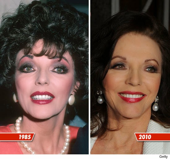 Joan Collins Plastic Surgery Before And After Facelift Pictures
