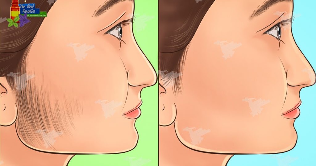 Home Remedies to Remove Facial Hair Permanently