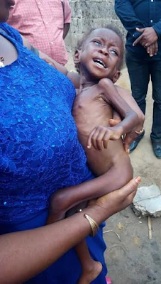 000 Photos: Nigerian doctor rescues severely malnourished child and her 16-year-old mother in Calabar