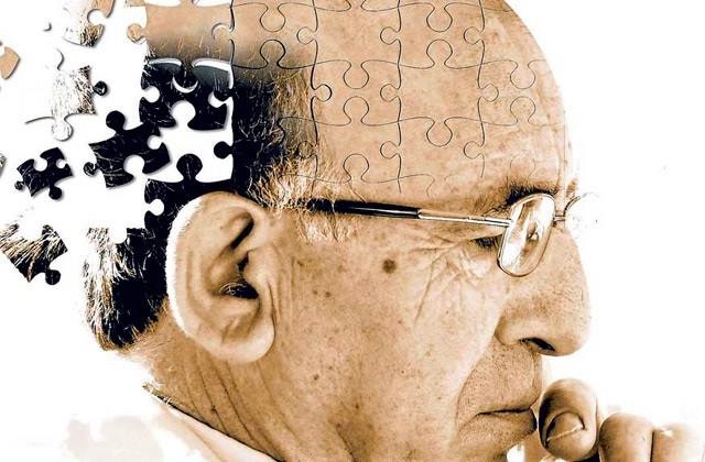 Mi Universar: Mal de Alzheimer