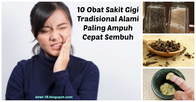 Nggak Perlu Ke Dokter Kalau Sakit Gigi Sudah Mulai Terasa Nggak Perlu Ke Dokter Kalau Sakit Gigi Sudah Mulai Terasa
