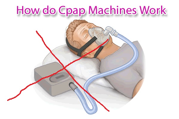 How To Cure Sleep Apnea Naturally At Home Without Cpap