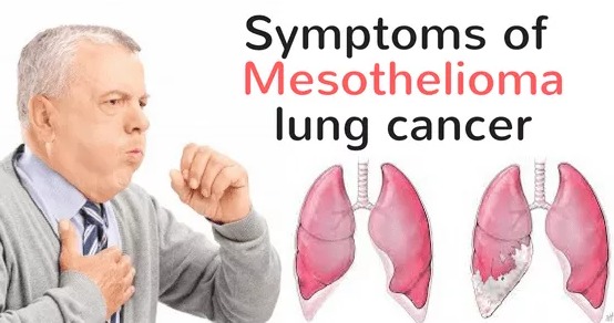 Mesothelioma Cancer Symptoms