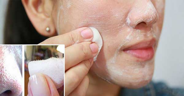 How to get rid of black heads with spending any cent