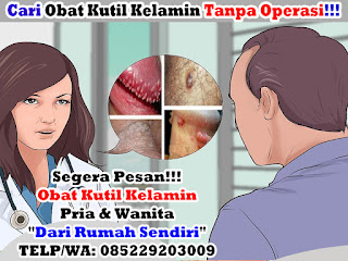 Obat kutil kelamin