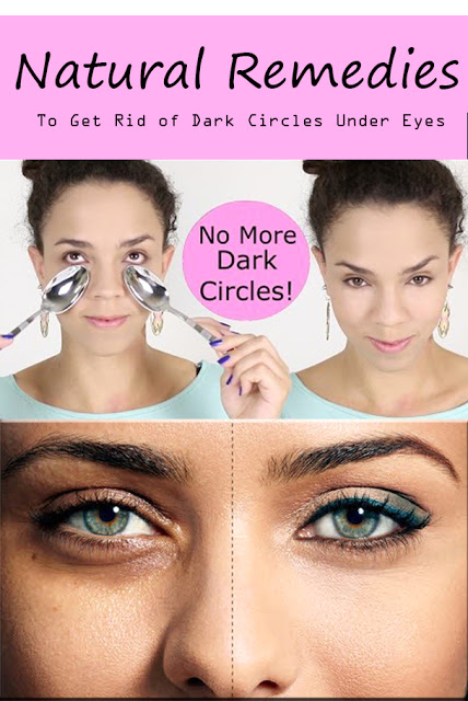 6 Natural Secret Remedies To Get Rid Of Dark Circles Under Eyes