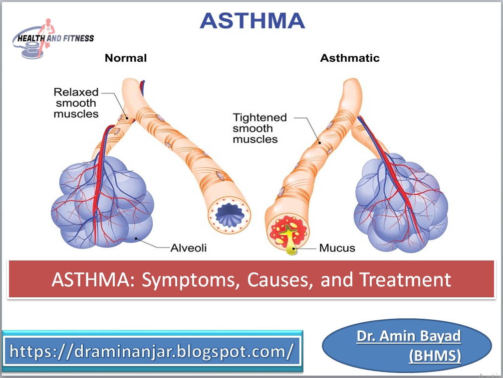Asthma symptoms, causes, and treatment Insurance & Healty