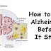 10 Things to Do to Prevent Alzheimer’s Disease