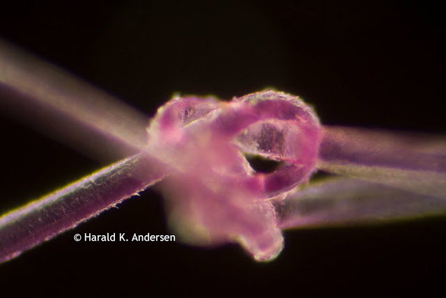 Hair captured under the microscope.