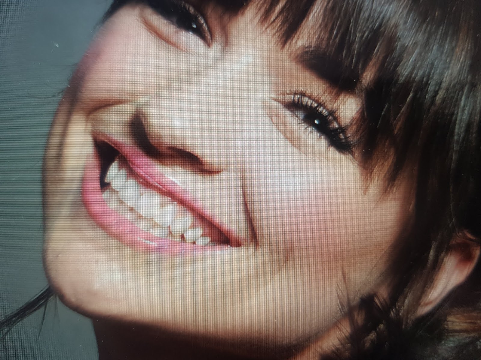 Vajina Daraltma Ameliyati Vajinoplasti