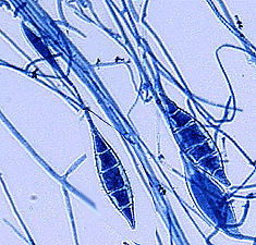 microsporum_canis.gif