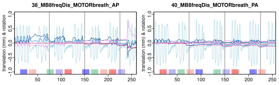 MVPA Meanderings: multiband acquisition sequence testing: respiration