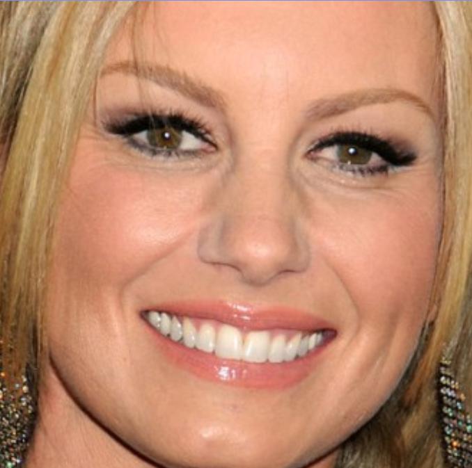 Faith Hill teeth with braces Female Celebrities Teeth