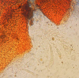 micro of orange nectria