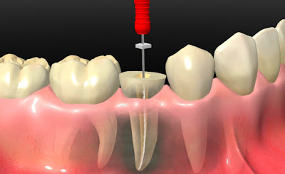 INFORMACIÓN SOBRE TRATAMIENTOS DE ESTÉTICA DENTAL