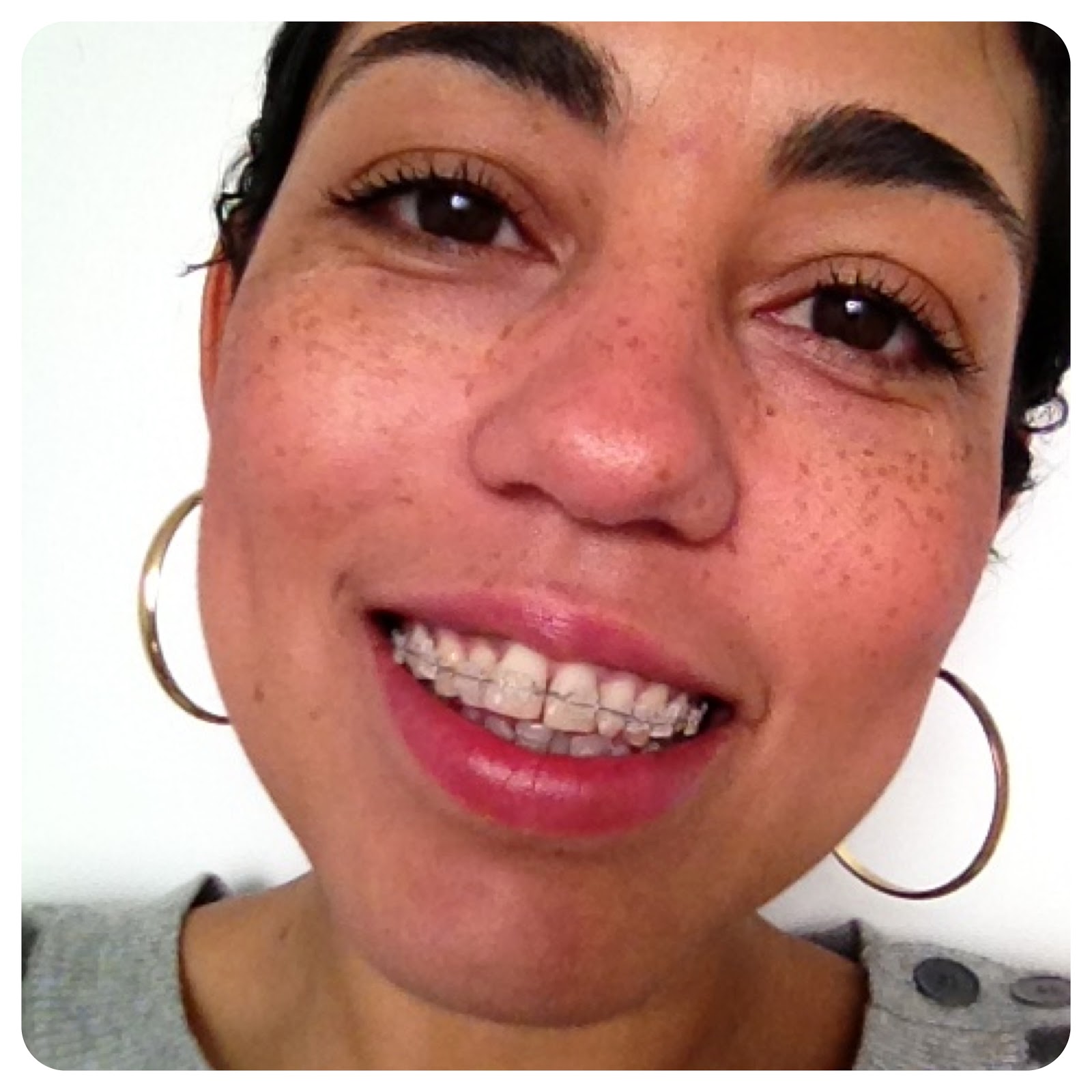 OOTD Gap Squares and Wiggles + Say Hello to My Braces! Fashion