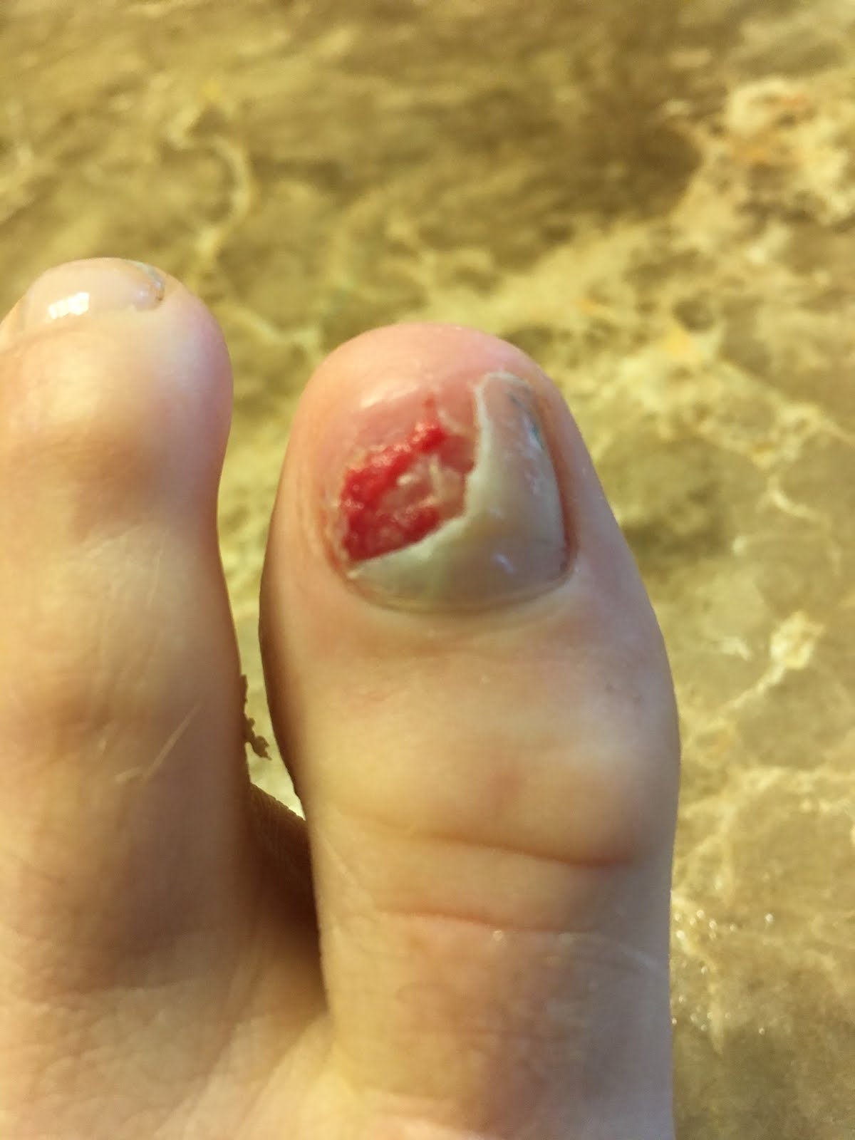 Age Does Not Bring Wisdom, But it Does Give Perspective Oh, The Toe