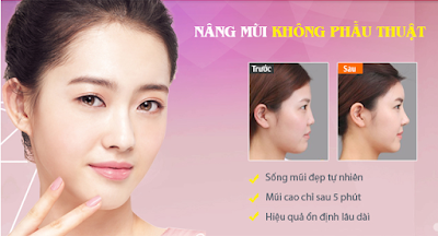 Nâng mũi không phẫu thuật radies hết bao nhiêu?