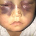 Une fillette de 4 ans enchaînée et battue par son père