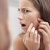   Acne é doença de pele mais comum na população brasileira