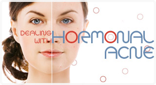 10 Ways To Balance Your Hormones for Wellness - Health