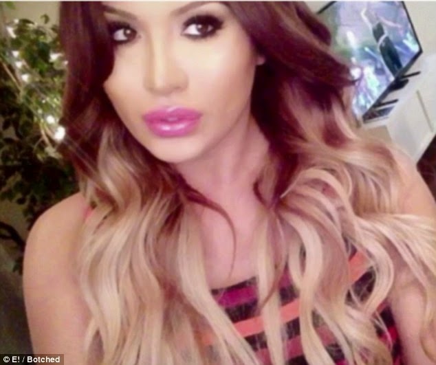 J. Lo's Boyfriend's Alleged Transgender Mistress Admits She Has Spent $100,000 On Plastic Surgery