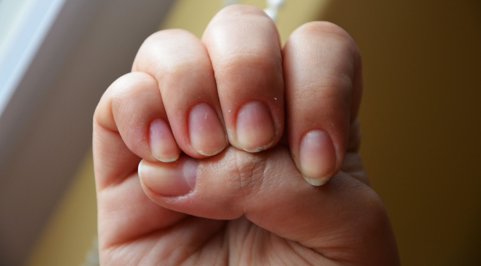 kuracja-nail-tek kuracja-nail-tek