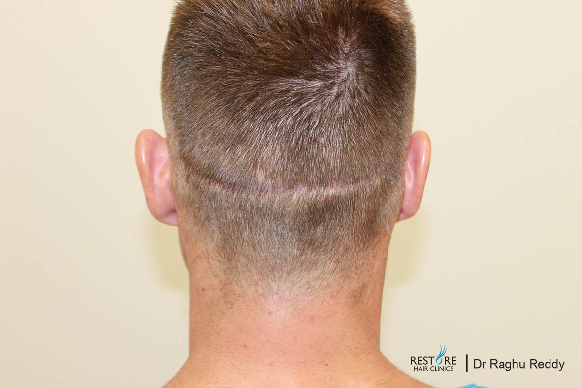 Scar clinic near me Clearance