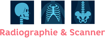 Les principes d'imagerie médicale par la radiologie et le scanner