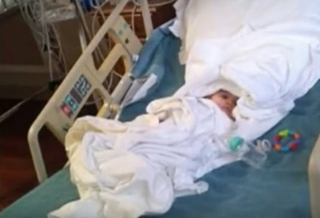 Dokter Terkejut Melihat Muka Bayi 7 Bulan ini, Anda Pasti Kasihan Melihatnya Dokter Terkejut Melihat Muka Bayi 7 Bulan ini, Anda Pasti Kasihan Melihatnya