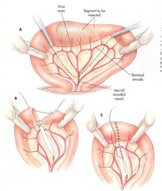 Enterotomy dan Enterectomy pada Hewan (Bedah Veteriner)