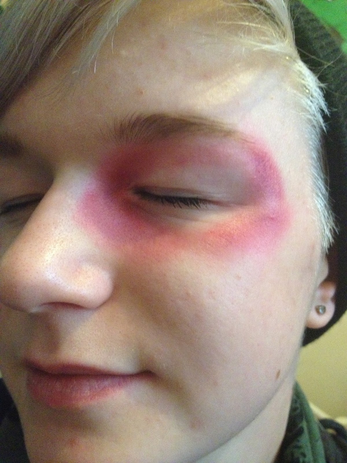 Caitlyn, Ellie and Stacey Practical task Special Effects Bruises